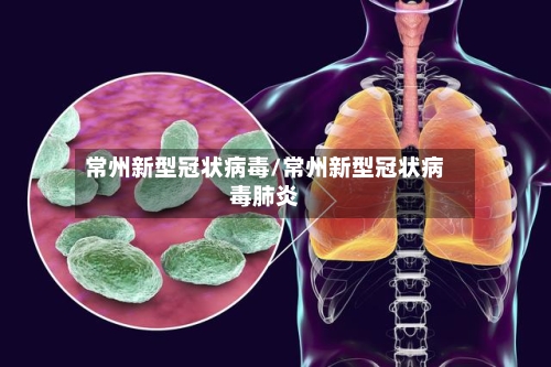 常州新型冠状病毒/常州新型冠状病毒肺炎-第2张图片