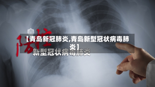 【青岛新冠肺炎,青岛新型冠状病毒肺炎】-第2张图片