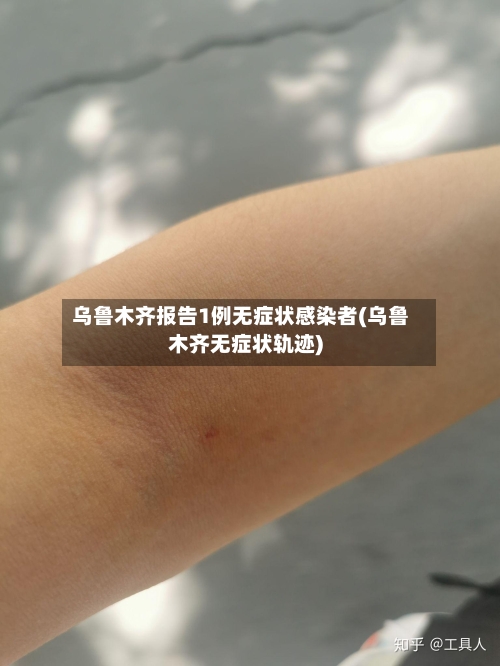 乌鲁木齐报告1例无症状感染者(乌鲁木齐无症状轨迹)-第2张图片