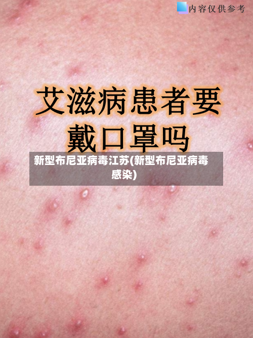 新型布尼亚病毒江苏(新型布尼亚病毒感染)-第2张图片